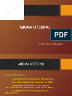 Mioma Uterino