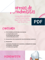 Formas de Periodontitis