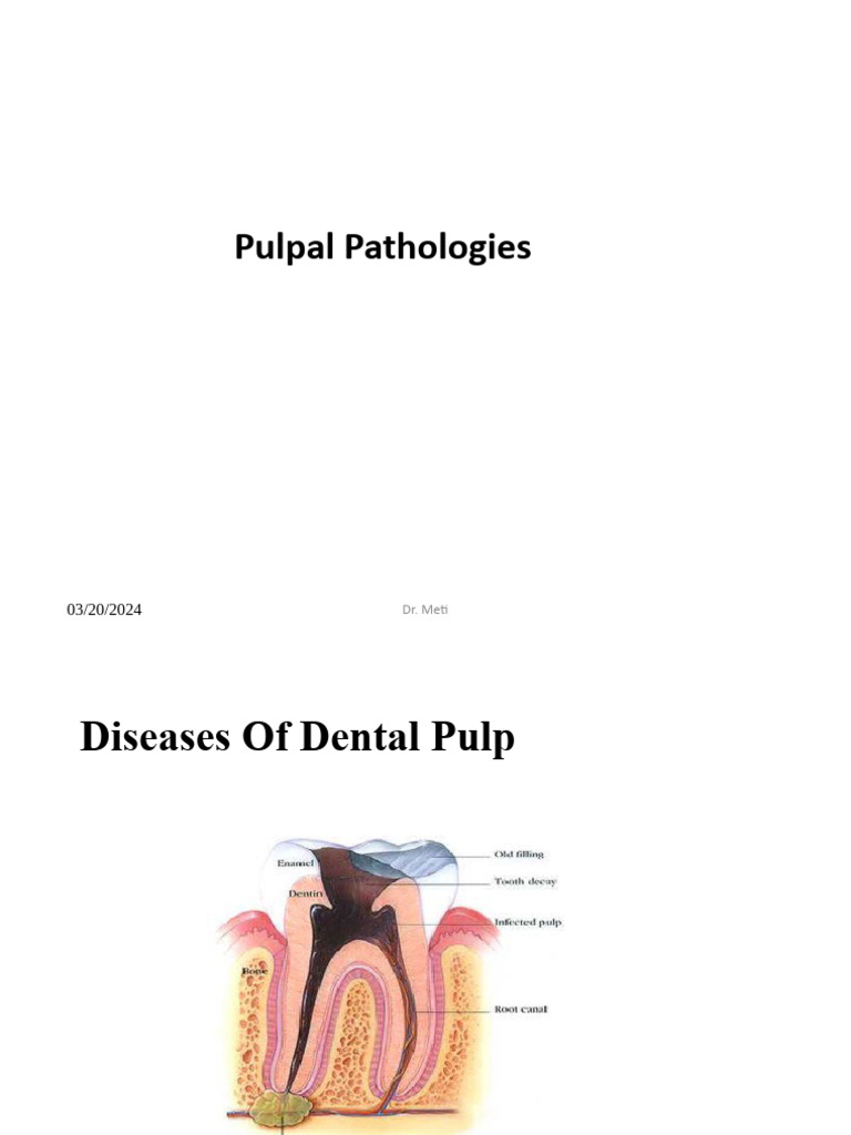 Understanding Pulpal Pathologies in Dentistry | PDF | Tooth | Mouth