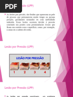 Coberturas para Lesão por Pressão: Resumo | PDF | Enfermagem | Medicina ...