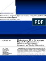 Estudio Dinamico Con Tem de Las Masas Hepaticas