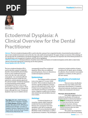 Ectodermal Dysplasia Wikipedia Ectodermal Dysplasia Patient Got Nasal