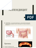 Аппендицит