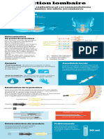 Infographie Ponction Lombaire