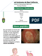 Ulceras Gastricas y Duodenales