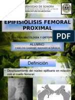 Epifisiolisis Femoral Proximal, Artosis de Cadera, Tratamiento Quirúrgico de Una Luxación Congénita de Cadera en El Adulto