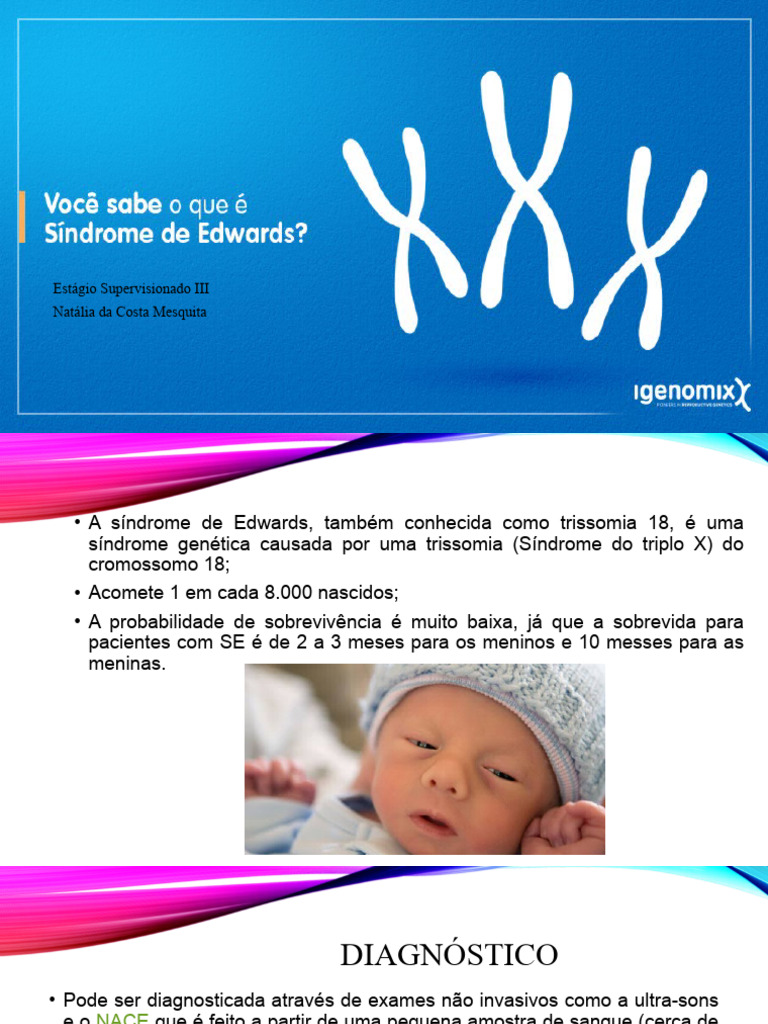 Sindrome de Edwards | PDF | Especialidades médicas | Remédio