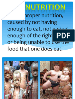 MALNUTRITION