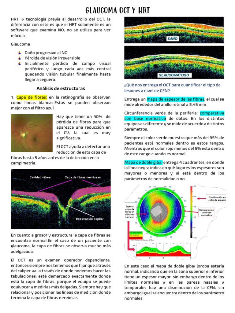 Análisis OCT y HRT en Glaucoma | PDF | Glaucoma | Ojo humano