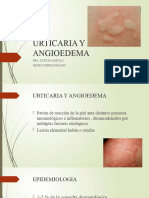 Urticaria y Angioedema