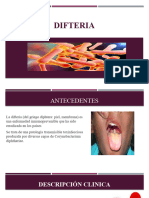 Difteria