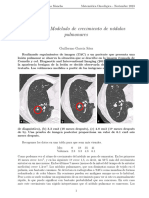 Práctica 3:modelado de Crecimiento de Nódulos Pulmonares: Guillermo García Sáez