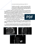 Miopericarditis en El Contexto de Infección Por COVID