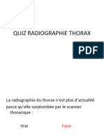 Quiz Radiographie Thorax