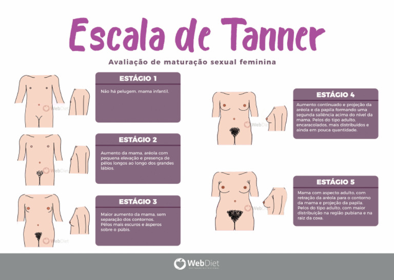 08 - Escala Da Tanner (Feminino) | PDF