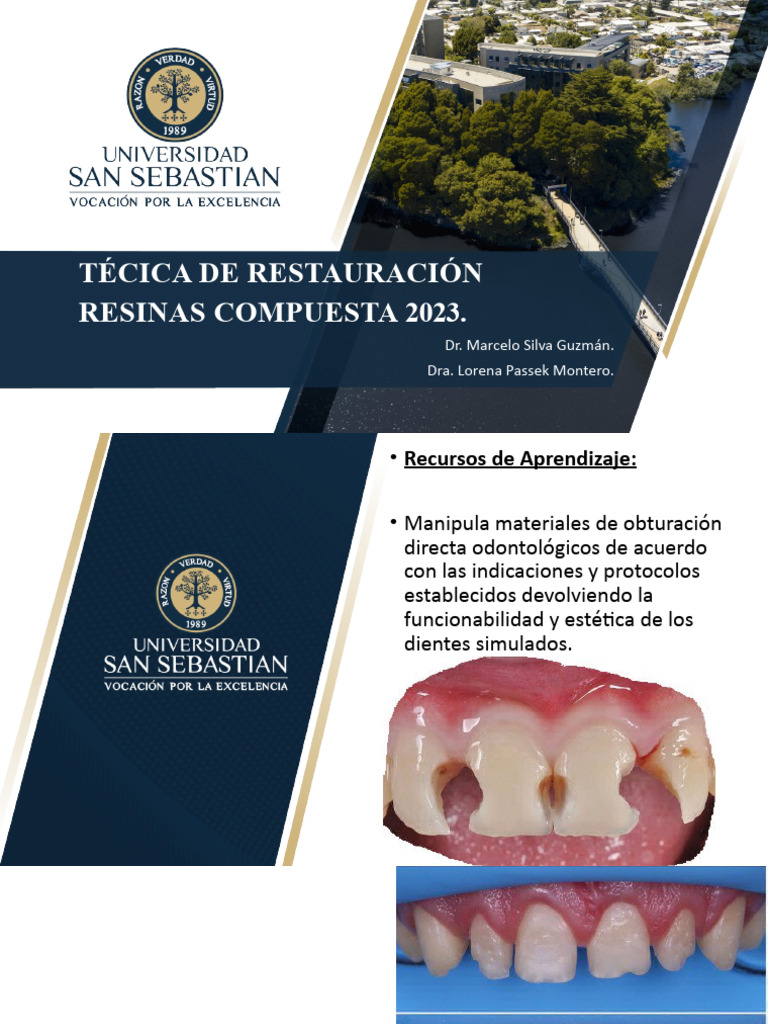 Restauración Dental con Resinas Compuestas | PDF | Compuesto Dental ...