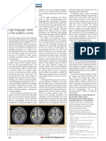 Sign Language Heard' in The Auditory Cortex: Scientific Correspondence