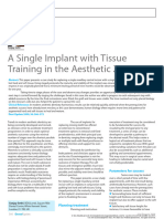 2009 - A Single Implant With Tissue Training in The Aesthetic Zone