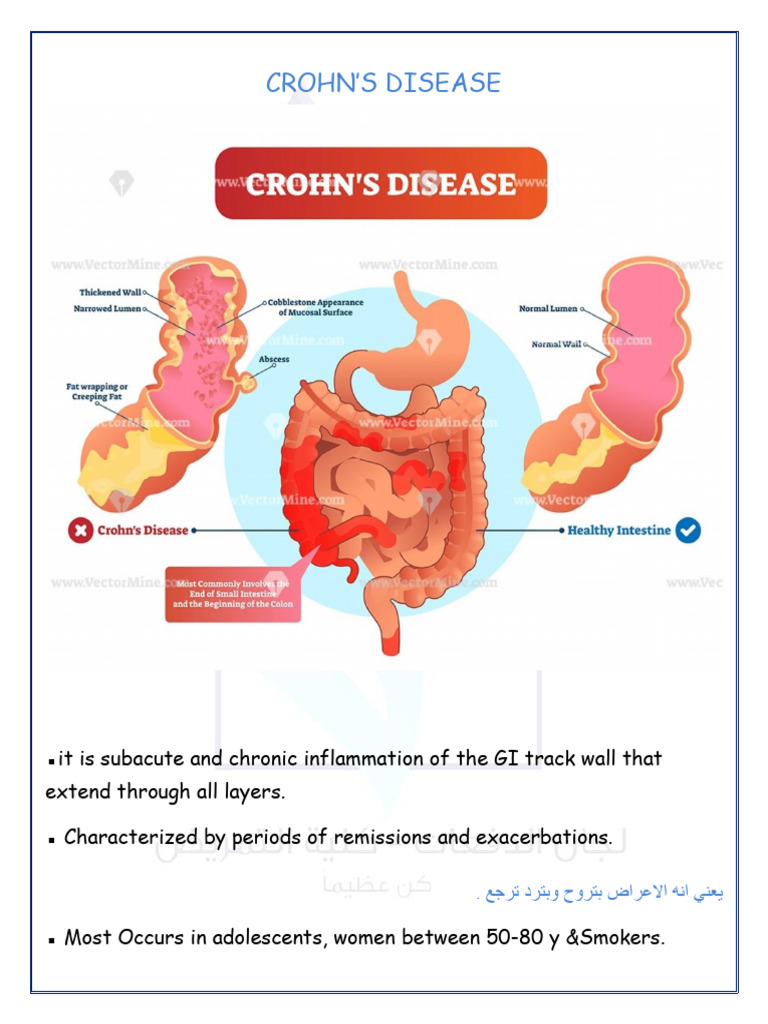 Crohns Disease PDF — free download