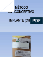 Implante Chip 2023