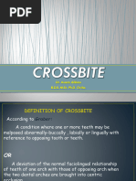 Cross Bite