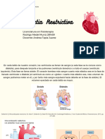 Miocardiopatia Restrictiva