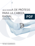 Sistema de Prótesis para La Cabeza Radial: Técnica Quirúrgica