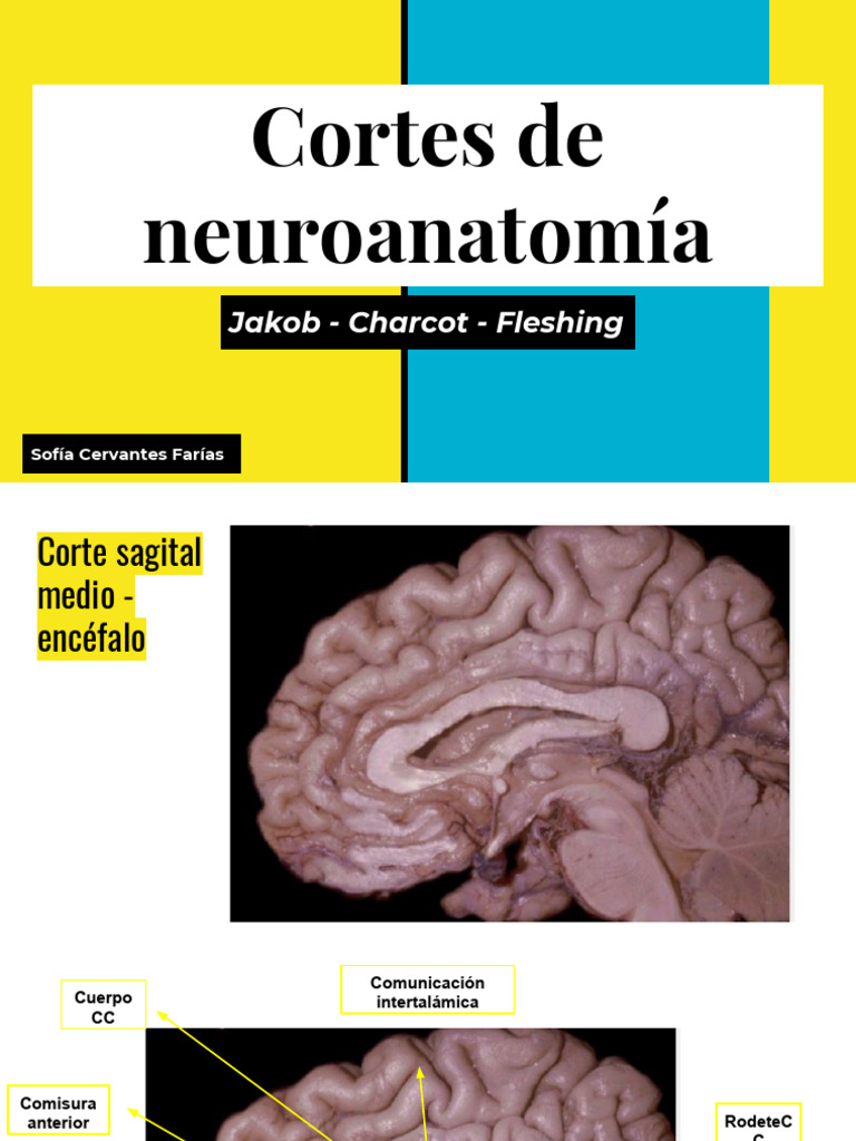 A New View of the Neonatal Brain: Clinical Utility of Supplemental  Neurologic US Imaging WindowsRadioGraphics, image size:768x1024