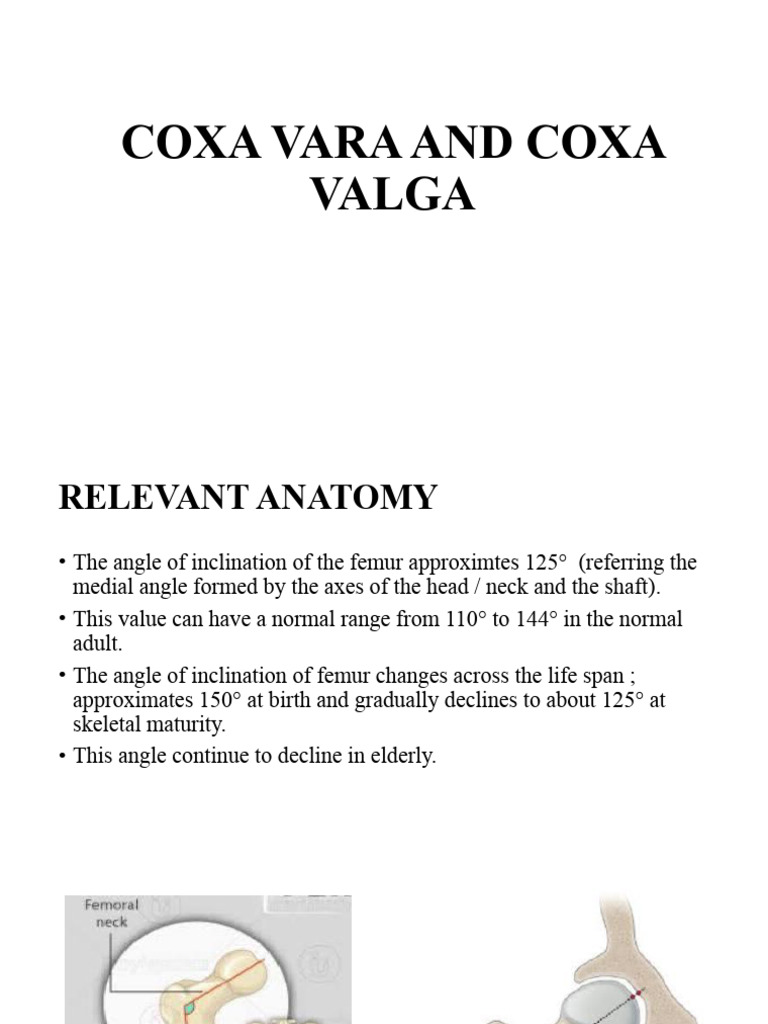 Understanding Coxa Vara and Valga | PDF | Hip | Skeletal System