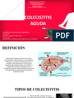 Colecistitis Duodenal