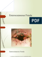 Enterocutaneous Fistula
