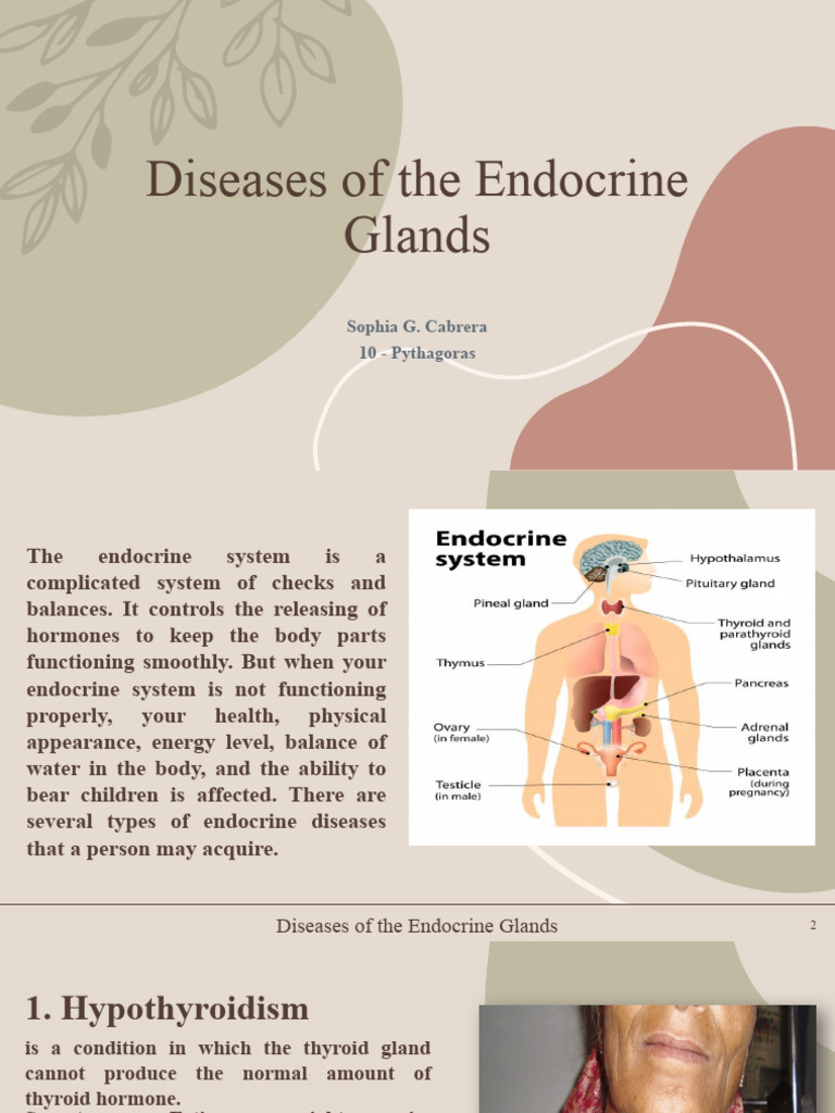 Diseases of The Endocrine Glands SOPHIA | PDF | Endocrine System ...