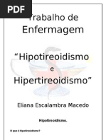 hipotiroidismo