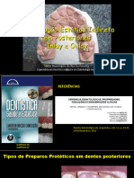 2 - Slides Restaurações Estéticas Indiretas Inlay-Onlay
