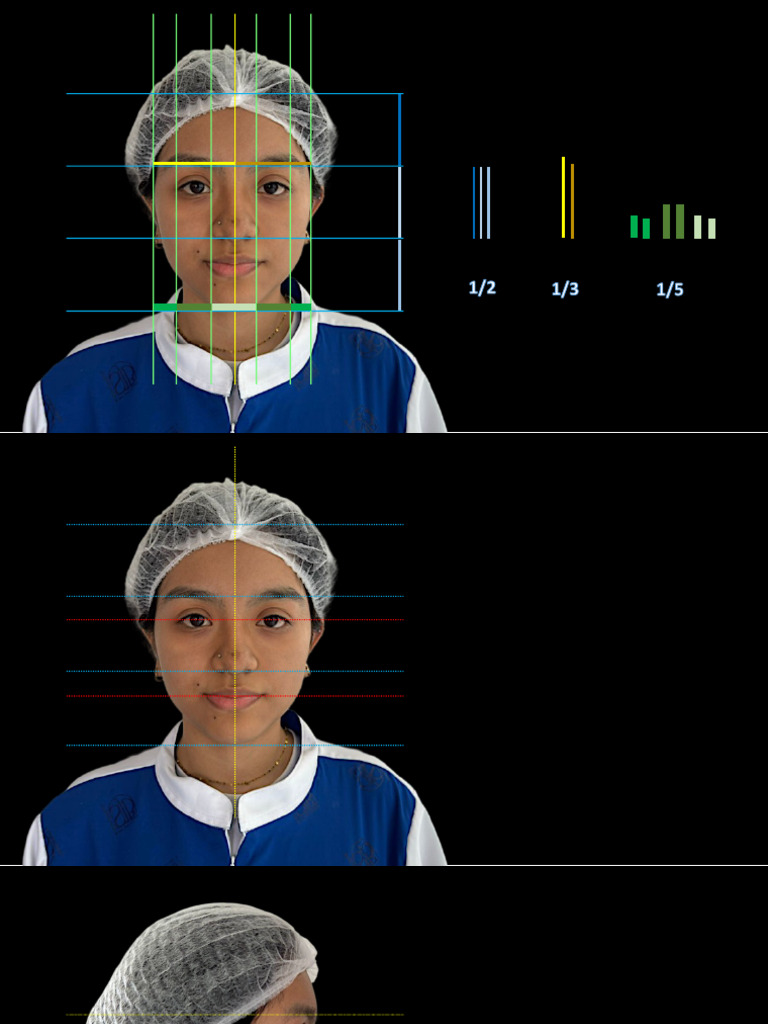Tercios y quintos | PDF