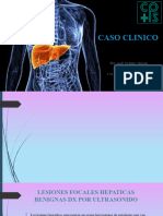 Caso Clinico Lesiones Hepaticas Simples