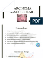 Carcinoma Basocelular