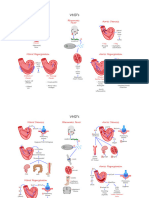 VHD'S: Mitral Stenosis Aortic Stenosis Rheumatic Fever