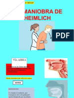 Tecnica de Heimchi