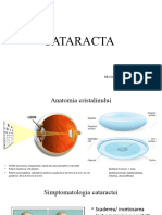 Cataract A