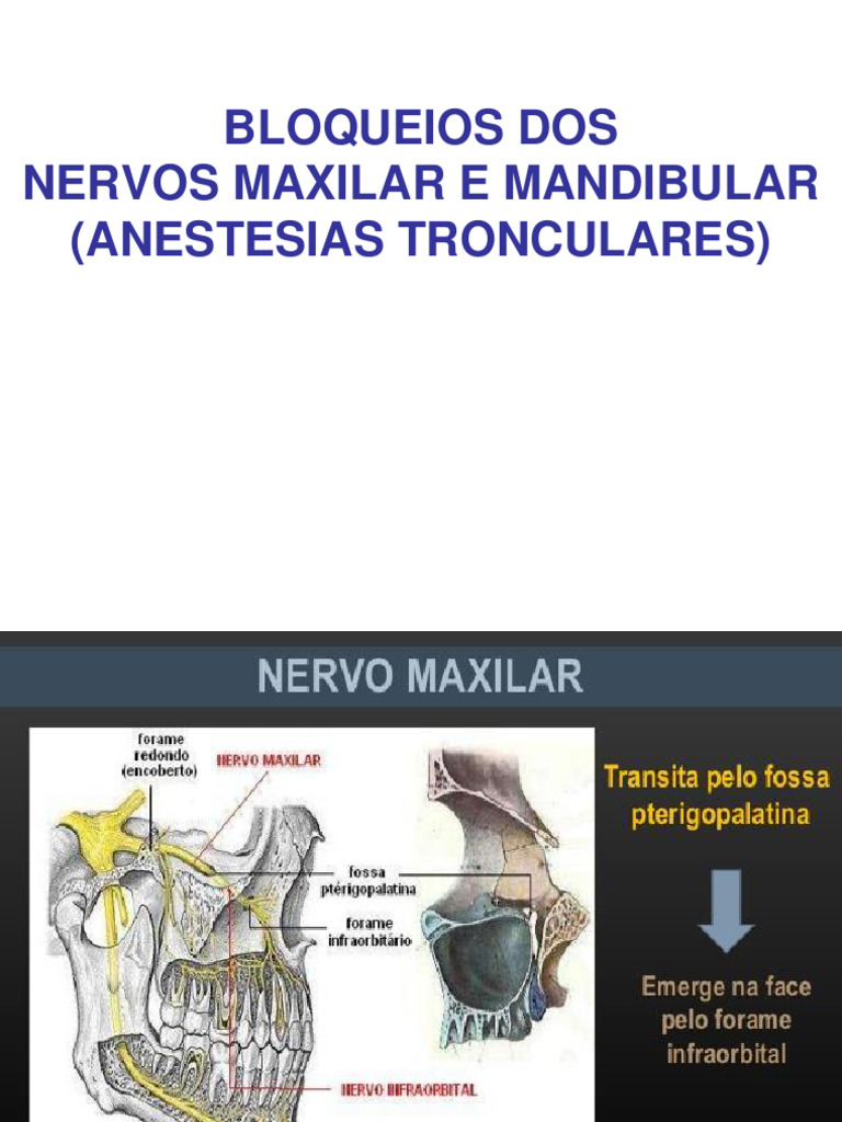 Bloqueios de Nervos Maxilar e Mandibular | PDF