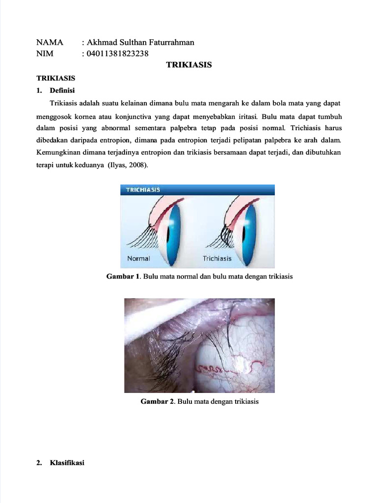 Trikiasis: Definisi dan Klasifikasi | PDF