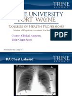 Chest Xrays