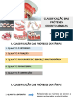 Classificação das Próteses Odontológicas (Segundo o Assentamento)