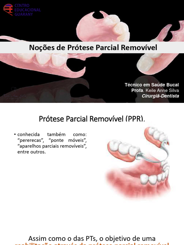 Noções de Prótese Parcial Removível | PDF | Dente humano | Prótese