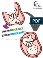 How To Turn A Breech Baby PDF Guide Care About Little Ones