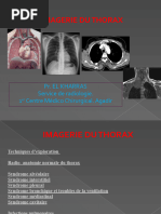 Signe de la silhouette en radiologie | PDF | Aorte | Thorax