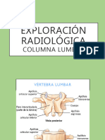Análisis del Ángulo Lumbosacro y Ferguson | PDF | La columna vertebral ...