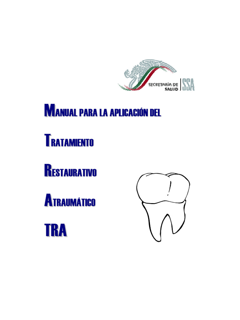 PERNI OPTICORE POST IDS VETRO 1,2 X12PZ - Foto 11