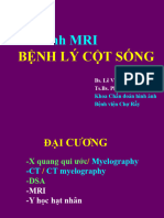 (Noitiethoc - Com) Hinh Anh MRI Benh Ly Cot Song